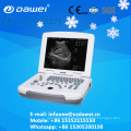 DW-500 Diagnose Ultraschallgerät Laptop Ultraschall-Scanner